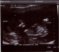scan.jpg